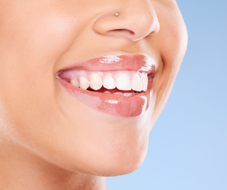 Faccette dentali: la tua arma segreta per un sorriso perfetto